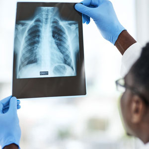 A man in a lab coat holding up an x-ray, examining it closely for medical diagnosis and analysis - Moss Bollinger LLP